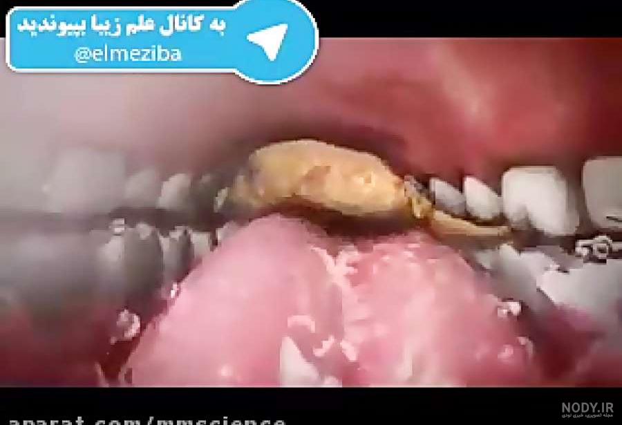 آناتومی شکم انسان چیست؟ تشخیص انواع بیماری‌های شکمی