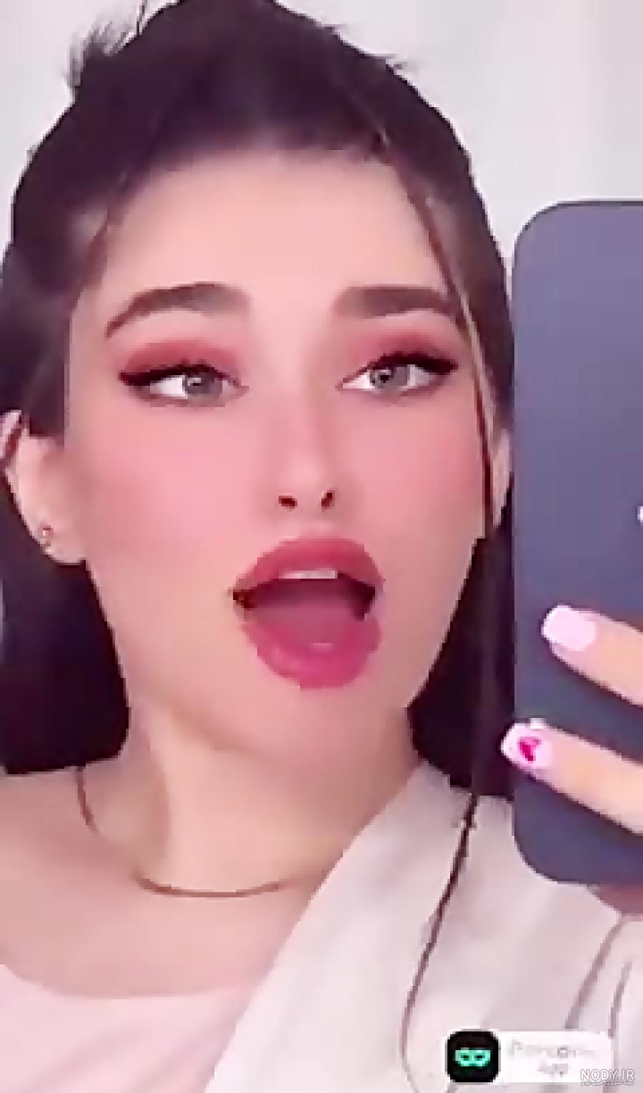 عکس صورت اکس بند عکس صورت اکس بند