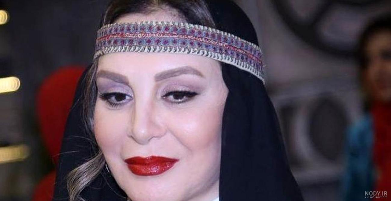 عکس تزریق ژل لب روسی عکس تزریق ژل لب روسی