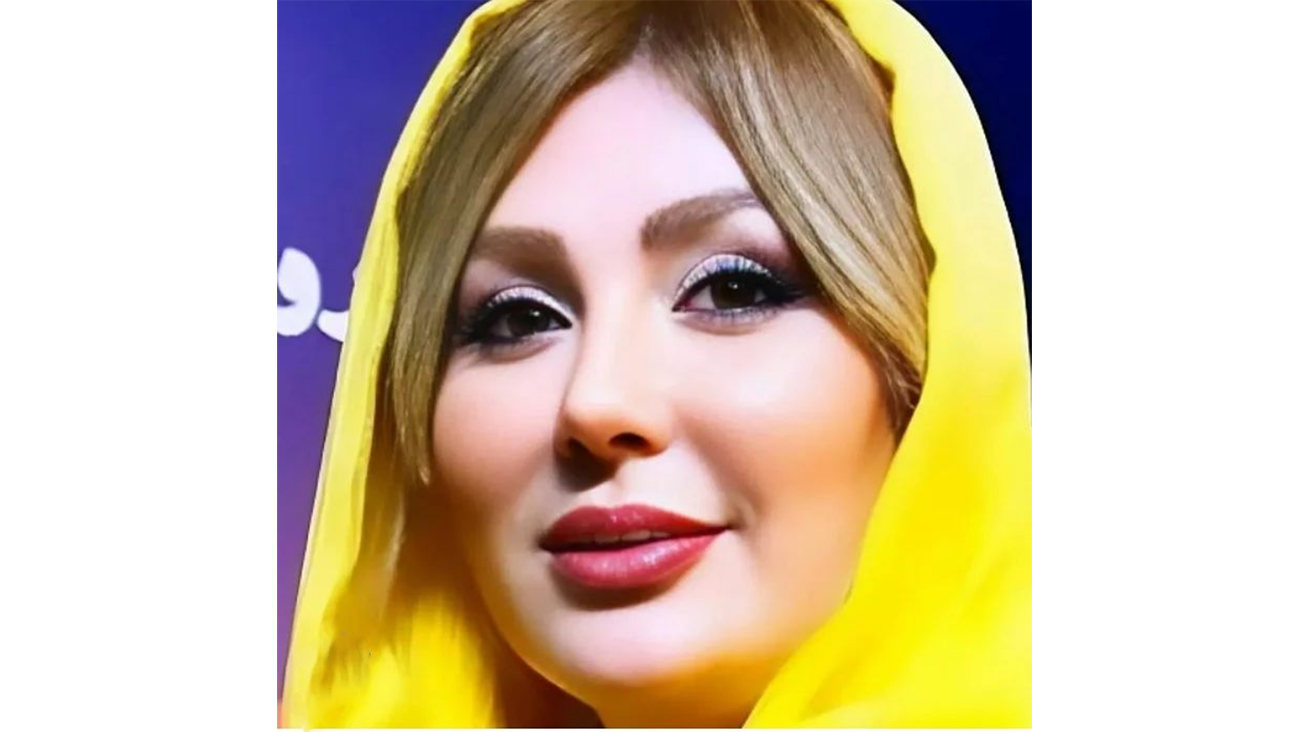 عکس تزریق ژل لب قبل و بعد عکس تزریق ژل لب قبل و بعد