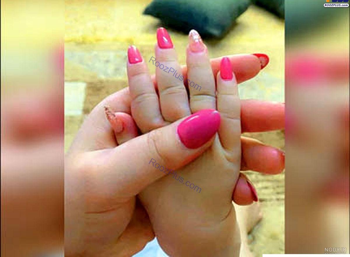 عکس زشت و زیبا ️ [ بهترین تصاویر ]