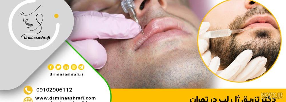 عکس| وحشت نکنید! این زن با تزریق ژل به لب‌هایش می‌خواهد رکورد گینس ...