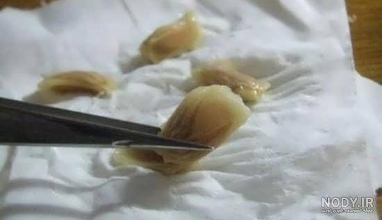 عکس سبزه دانه پرتقال