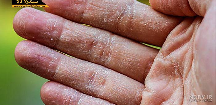 خرید و قیمت صابون زردچوبه اصل | صابون سفید کننده پوست - سیندرلا کالا