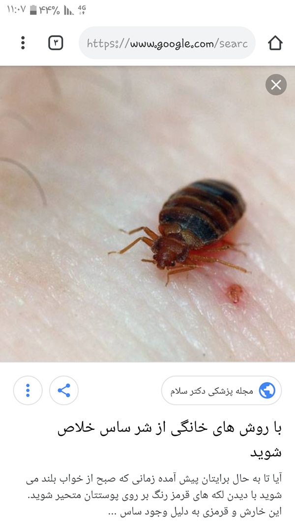 مجموعه عکس جای نیش ساس نی نی سایت (جدید) مجموعه عکس جای نیش ساس نی نی سایت (جدید)