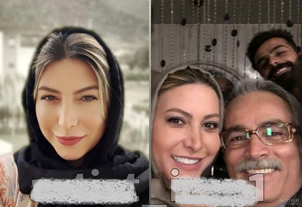 عکس فریبا نادری بعد عمل - عکس نودی