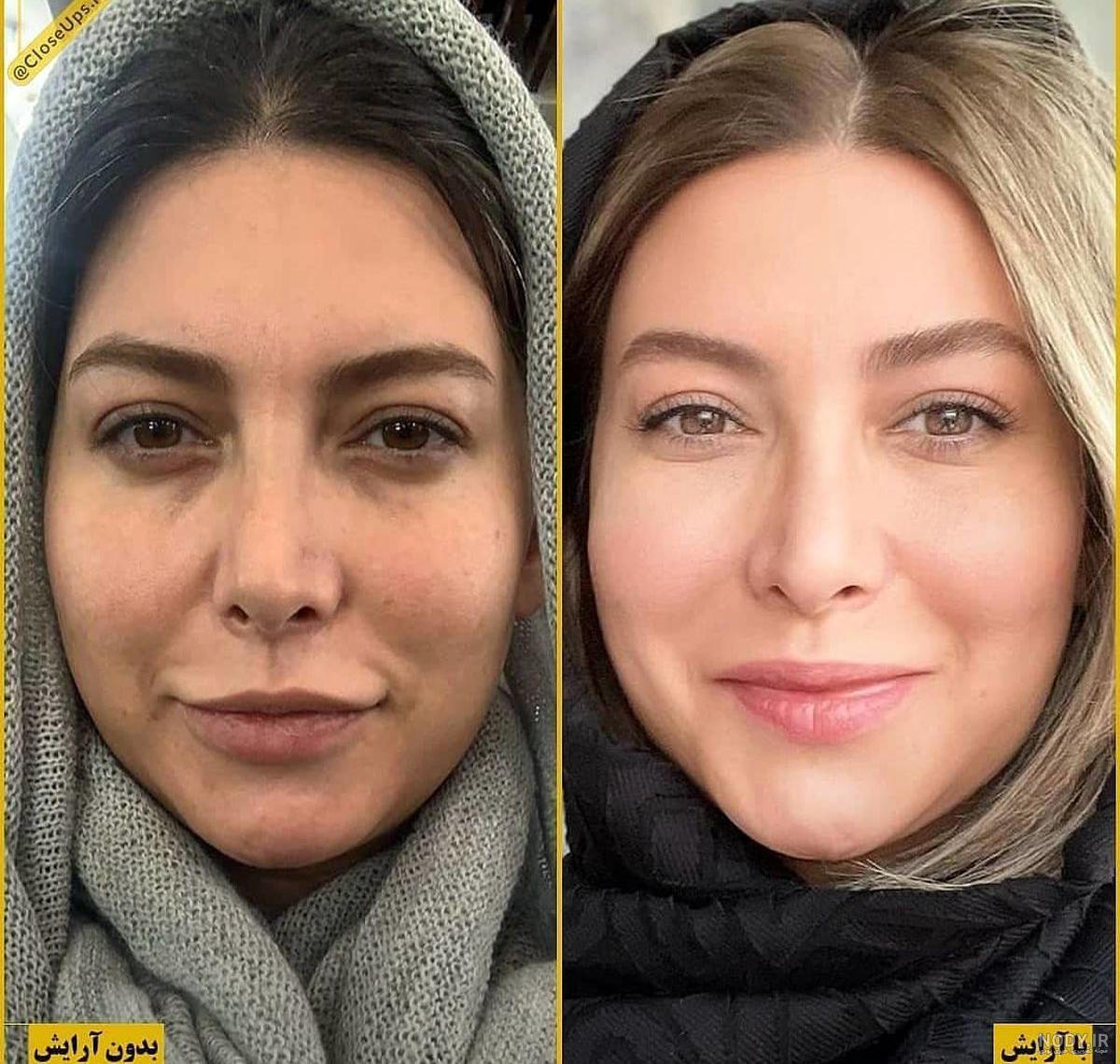عکس فریبا نادری بعد عمل - عکس نودی