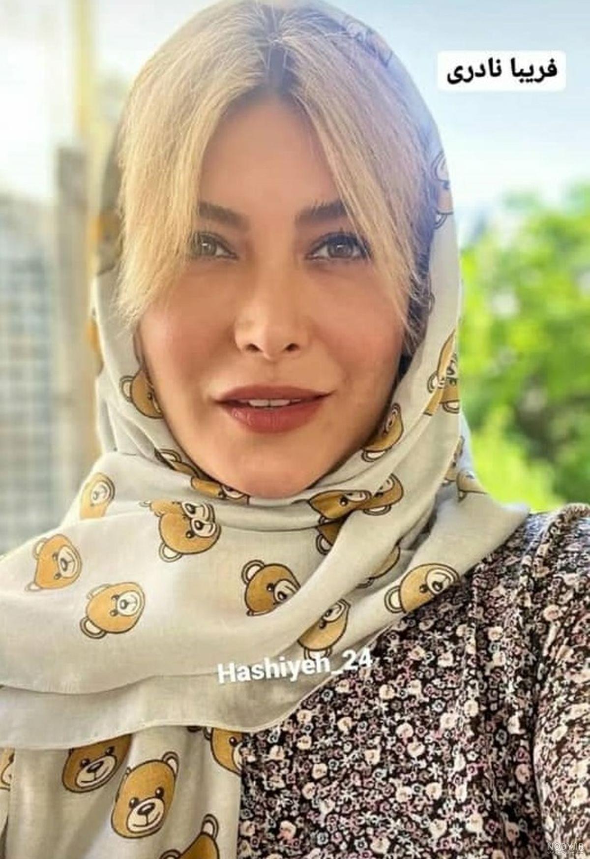 عکس فریبا نادری قبل از عمل بینی