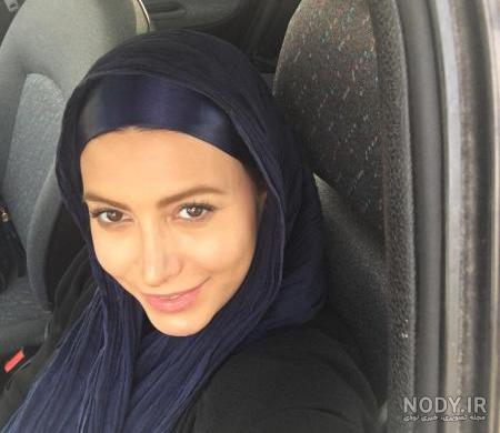 ملوسی فریبا نادری قبل از عمل های زیبایی + عکس زیبایی مصنوعی به جای ...