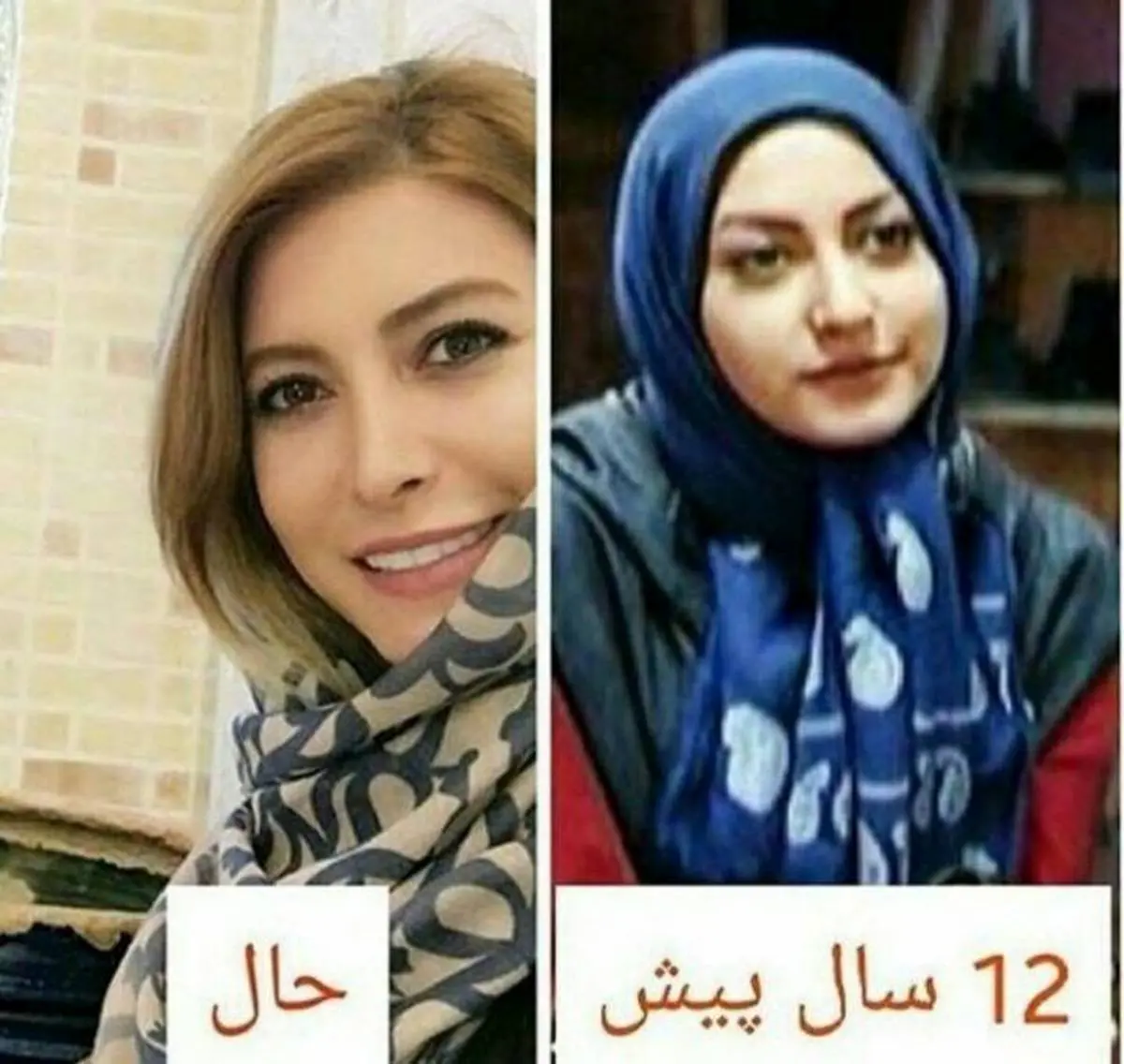 ملوسی فریبا نادری قبل از عمل های زیبایی + عکس زیبایی مصنوعی به جای ...