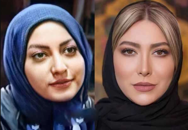 چهره فریبا نادری قبل و بعد از عمل زیبایی | بیوگرافی فریبا نادری
