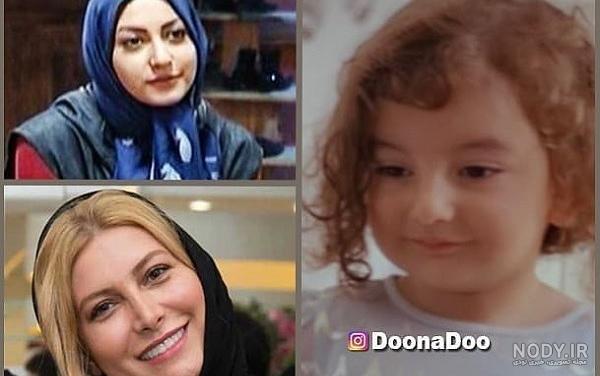 چهره قبل از عمل زیبایی فریبا نادری ! / عجیب اما واقعی !