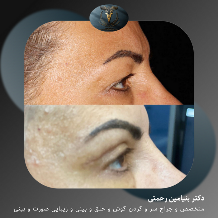 Benyamin Rahmati - Head of ENT Department of Arak University of ... Benyamin Rahmati - Head of ENT Department of Arak University of ...