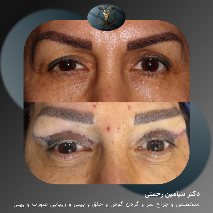 دکتر بنیامین رحمتی | جراح زیبایی بینی و صورت‎ (@dr_benyaminrahmaty ...