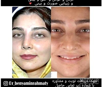 نوبت‌دهی(+آدرس و تلفن مطب) دکتر بنیامین رحمتی متخصص و جراح سر و ...