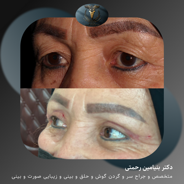 نوبت‌دهی(+آدرس و تلفن مطب) دکتر بنیامین رحمتی متخصص و جراح سر و ...
