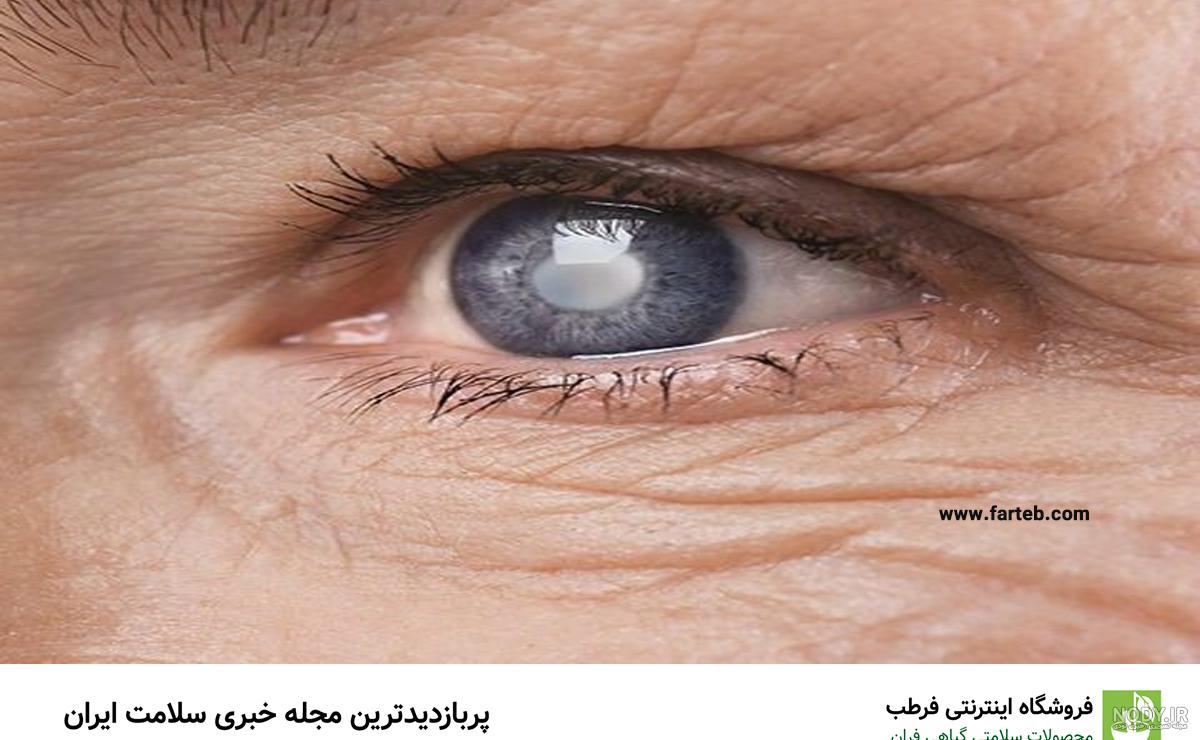 عکس یک چشم زیبا عکس یک چشم زیبا