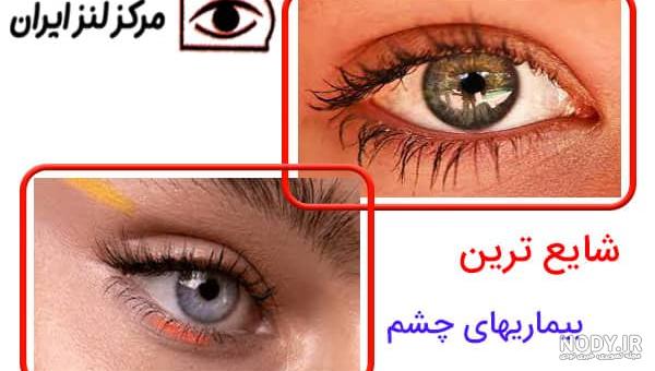چشم حیوانات : 30 عکس فوق‌العاده زیبا، عجیب و شگفت‌انگیز از چشم ...