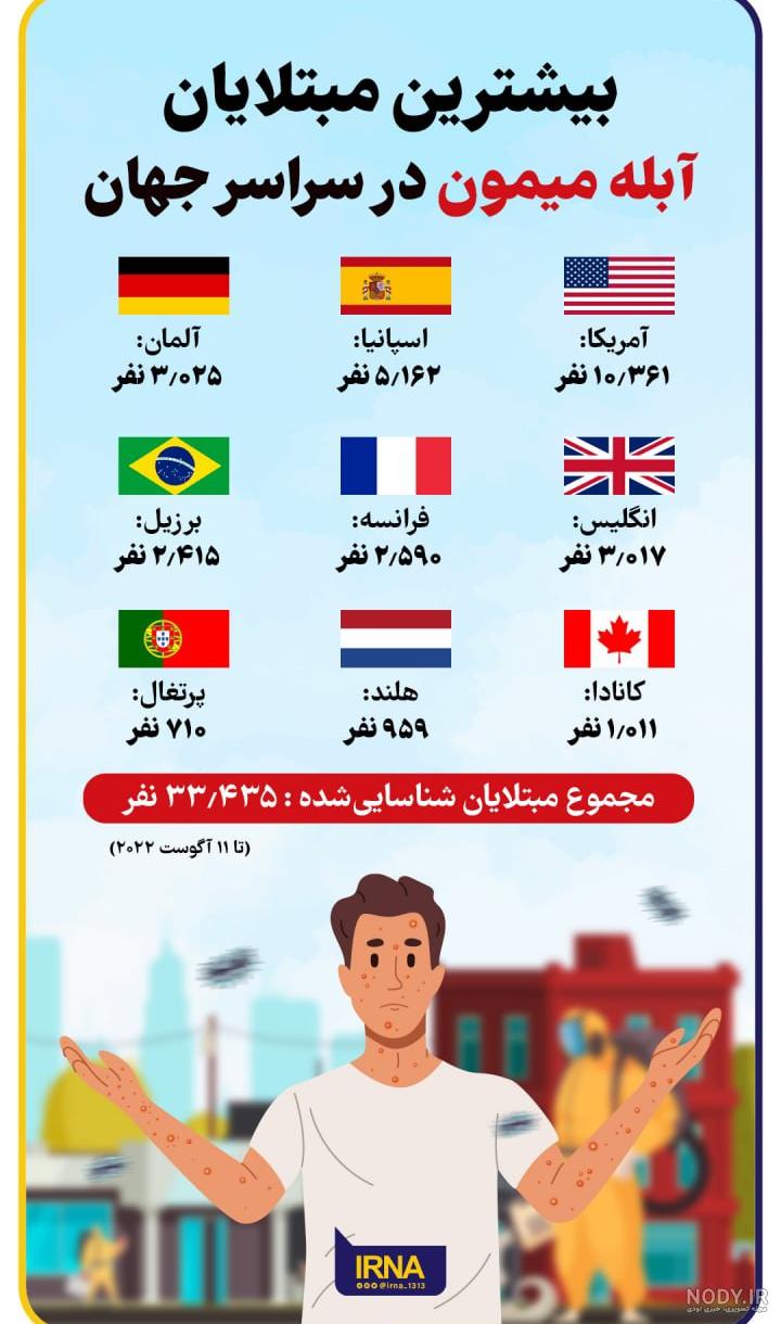 آبله میمونی چه علائم و نشانه هایی دارد؟ / عکس آبله میمونی چه علائم و نشانه هایی دارد؟ / عکس