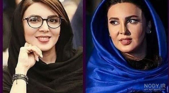 بررسی عمل زیبایی بازیگران + عکس قبل و بعد از عمل