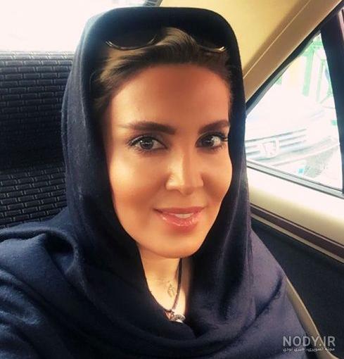توضیح خانم بازیگر در مورد عمل زیبایی اش+عکس | اقتصاد24