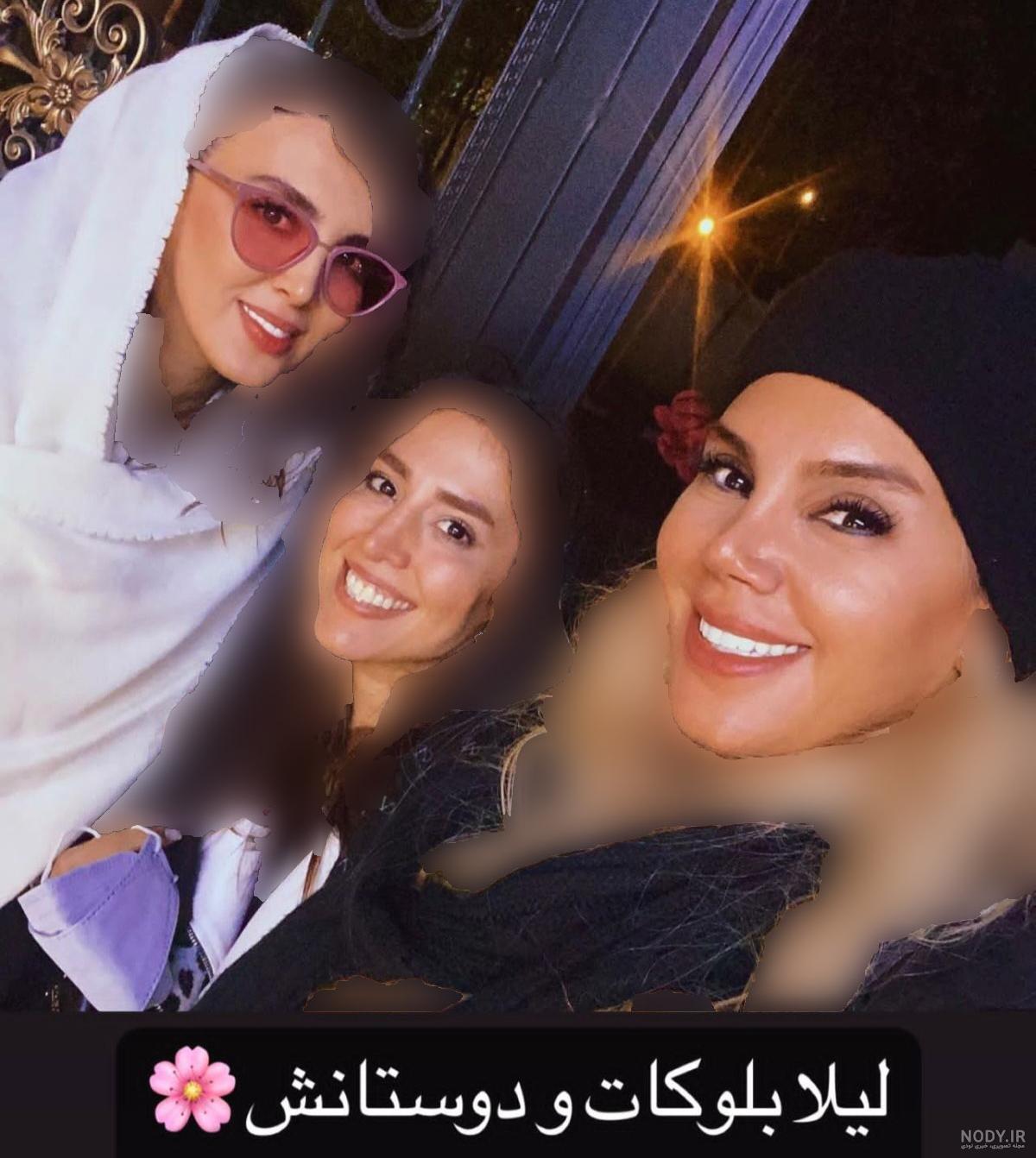 عمل زیبایی بینی بازیگر مشهور زن! +عکس های قبل و بعد از عمل زیبایی ...