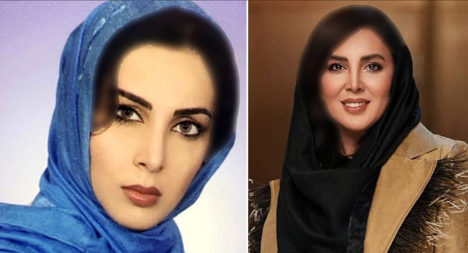 عکس زیر خاکی لیلا اوتادی بعد از اتاق عمل | تغییر قیافه عجیب لیلا ...
