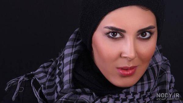 عکس لیلا بلوکات قبل از عمل