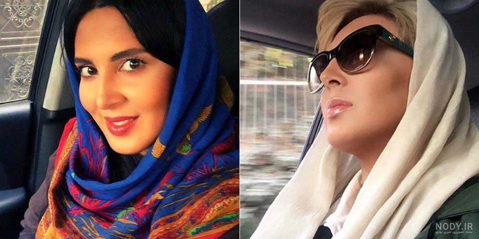 عکس لیلا بلوکات قبل از عمل زیبایی