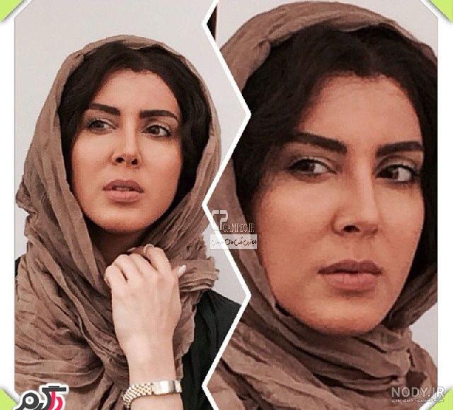 عکس های لیلا بلوکات قبل و بعد از عمل زیبایی بینی +عکس عکس های لیلا بلوکات قبل و بعد از عمل زیبایی بینی +عکس