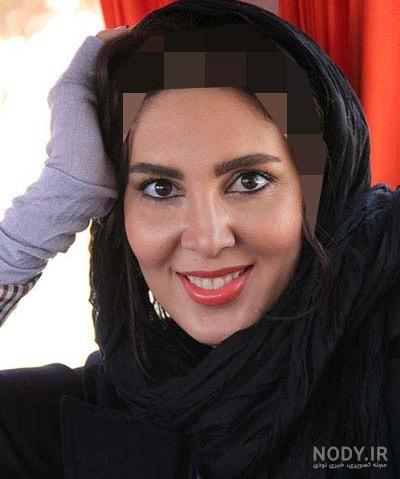 لیلا بلوکات قبل از عمل زیبایی - عکس ویسگون