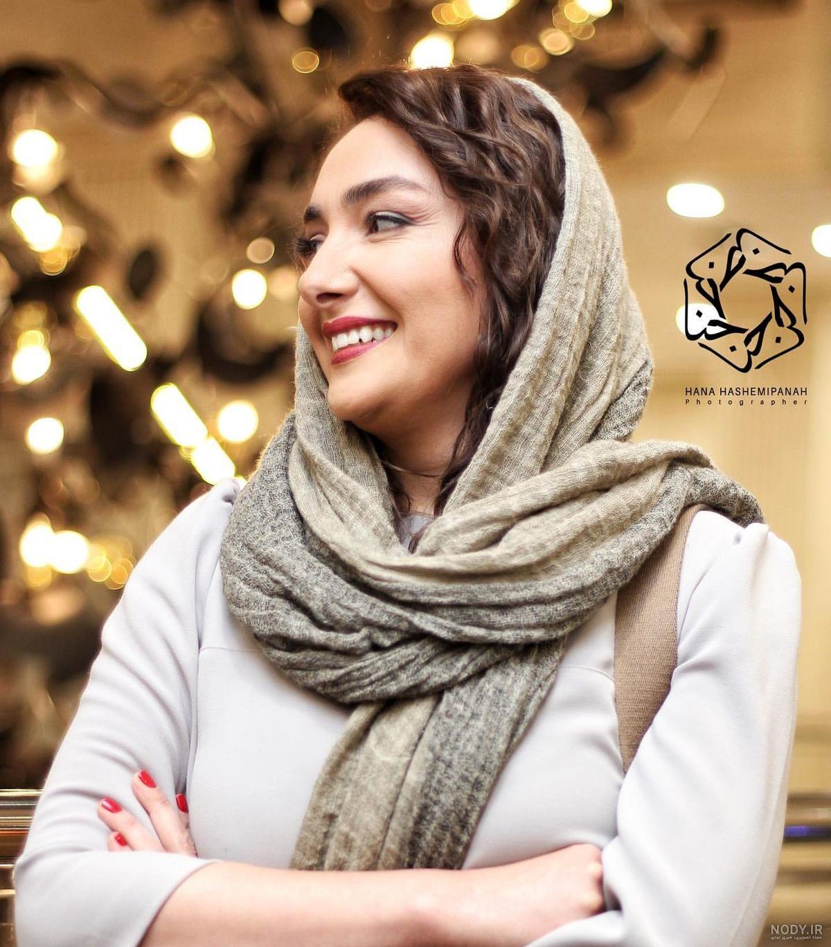 عکس شوک آور از هانیه توسلی قبل از عمل زیبایی | هانیه توسلی چی بود چی