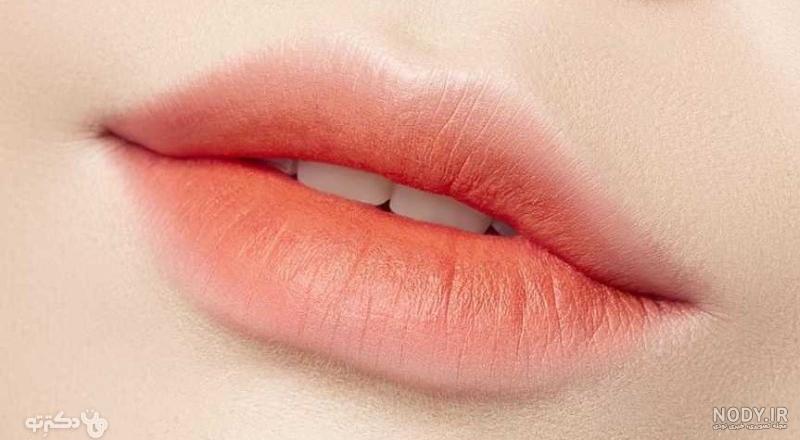 دکتر تزریق ژل لب: برای تزریق ژل لب به کدام دکتر مراجعه کنم | دکتر ...