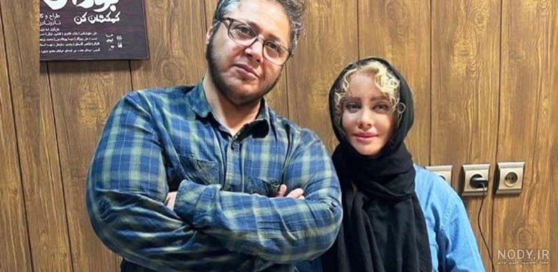 عکس شهره لرستانی قبل و بعد