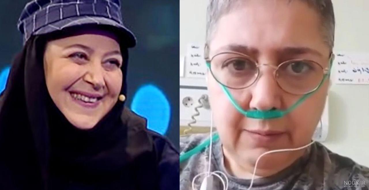 عکس شهره لرستانی قبل و بعد از عمل