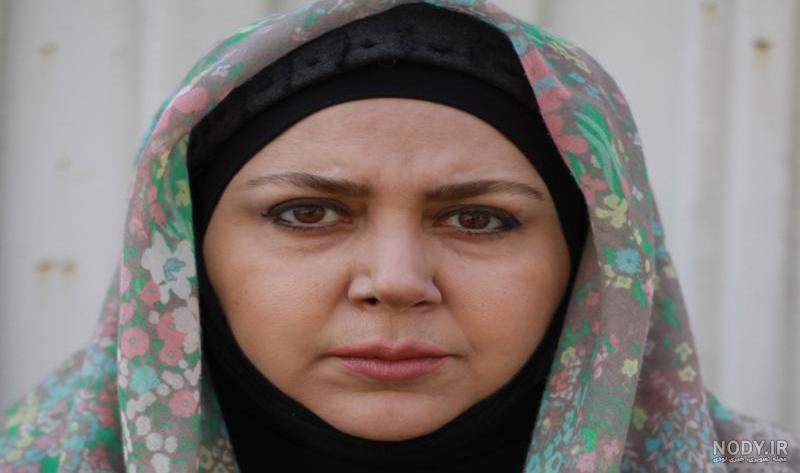 عکس شهره لرستانی قبل و بعد عمل