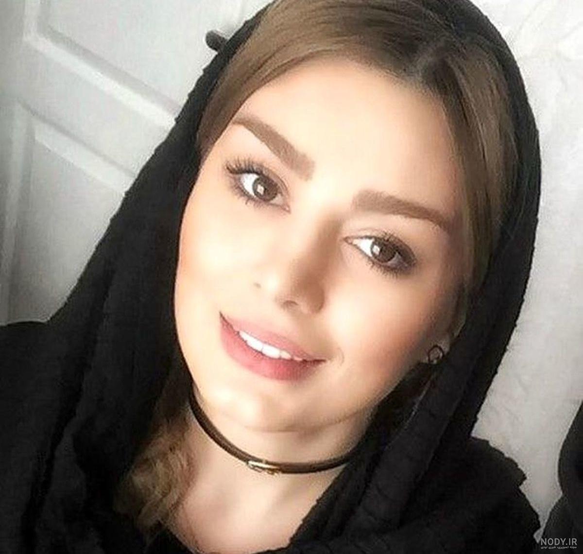 چاقی و تزریق بیش از حد سحر قریشی بعد از کم کار شدنش ! چاقی و تزریق بیش از حد سحر قریشی بعد از کم کار شدنش !