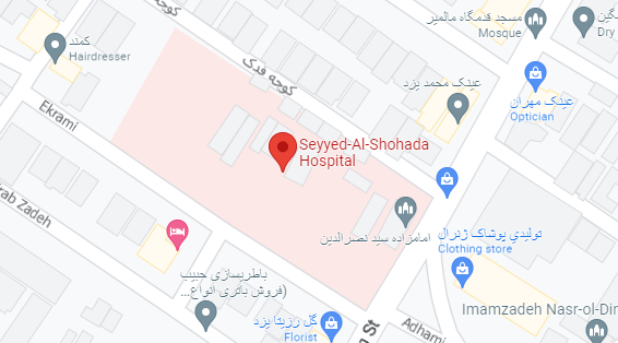گرفتن عکس چشم در یزد گرفتن عکس چشم در یزد