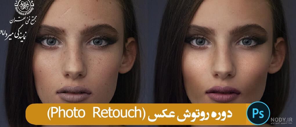 عکس چیست دندان