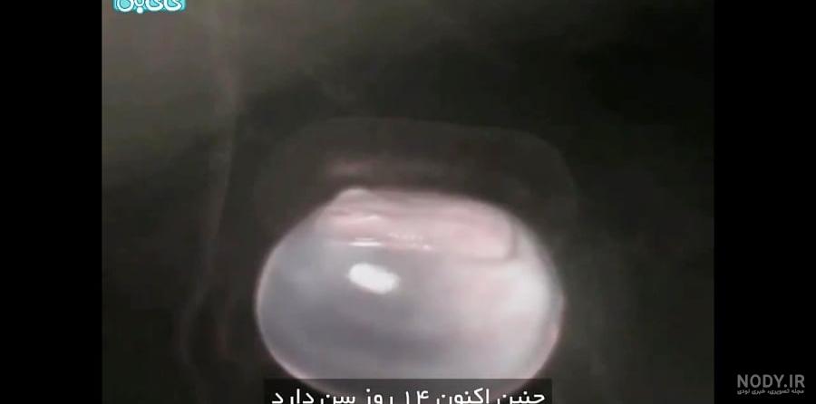 عکس جنین یک ماه در شکم مادر عکس جنین یک ماه در شکم مادر