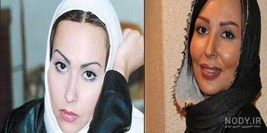 ظاهر آشفته «رویا میرعلمی»/عکس ظاهر آشفته «رویا میرعلمی»/عکس