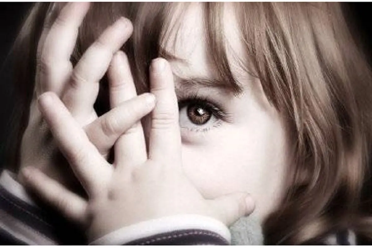 تصاویر انسان های ناقص الخلقه و عجیب جهان + نوزاد ناقص الخلقه