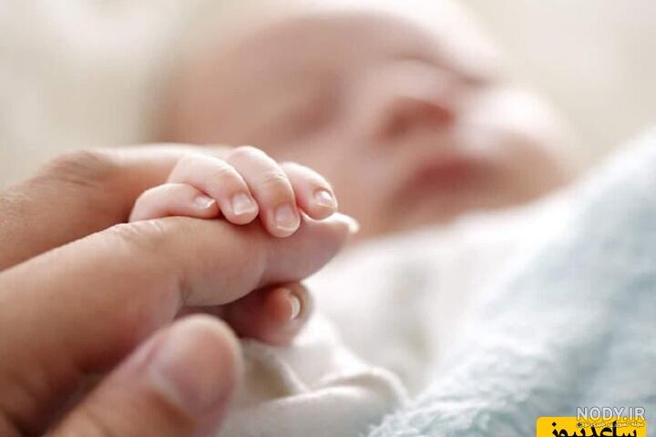 عکس بچه های عجیب الخلقه