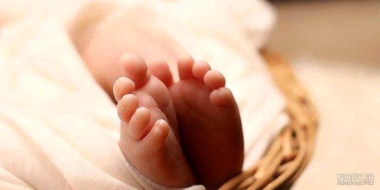 عکس نوزاد های عجیب