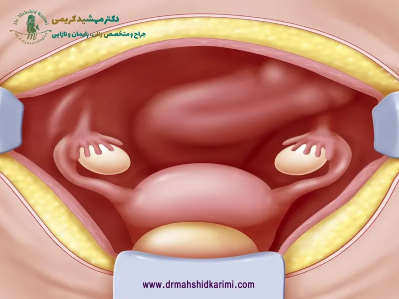 عکس رحم مادر باردار