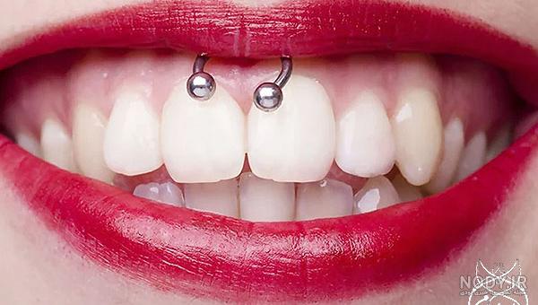 مراقبت از پیرسینگ تازه؛ چطور بفهمیم پیرسینگ عفونت کرده است؟ - خبرنامه مراقبت از پیرسینگ تازه؛ چطور بفهمیم پیرسینگ عفونت کرده است؟ - خبرنامه