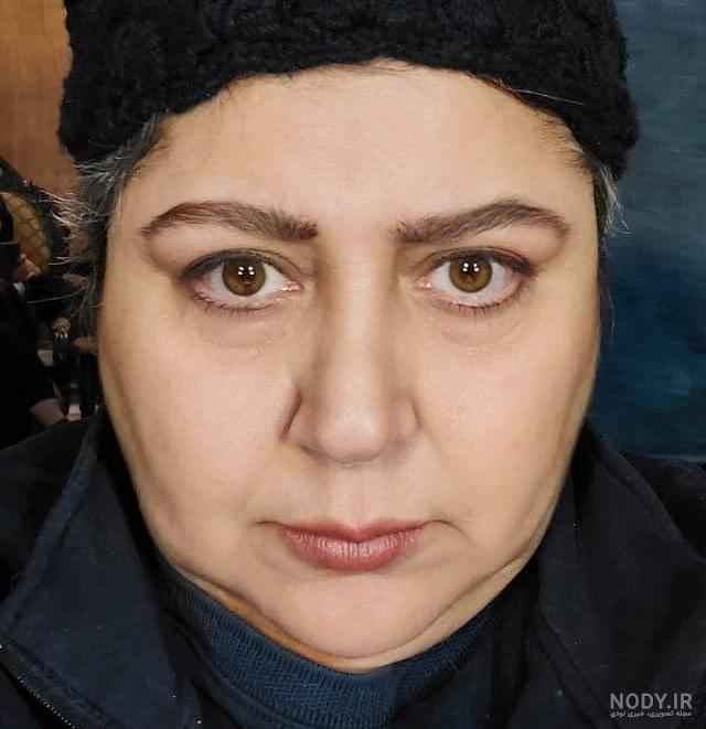 تغییر جنسیت شهره لرستانی + بیوگرافی کامل و اسم جدید • مجله تصویر زندگی