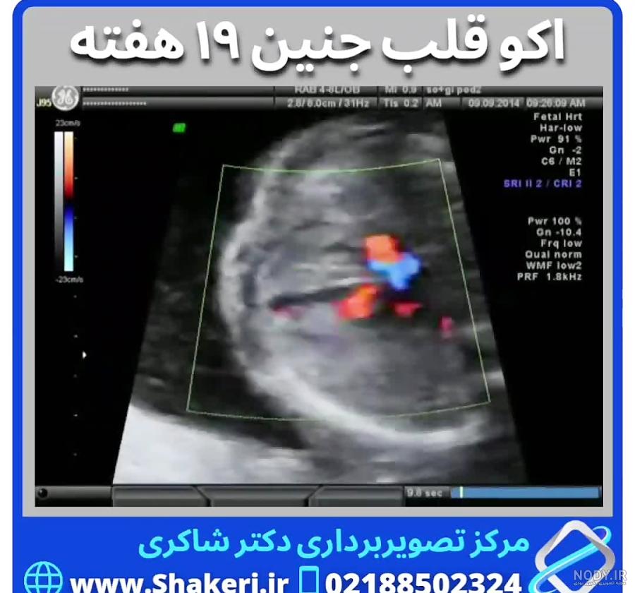 عکس جنین پسر در هفته 16