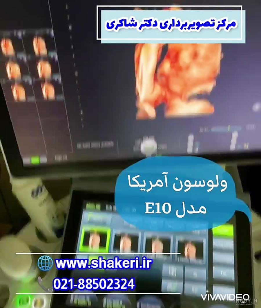 عکس جنین پسر 16 هفته
