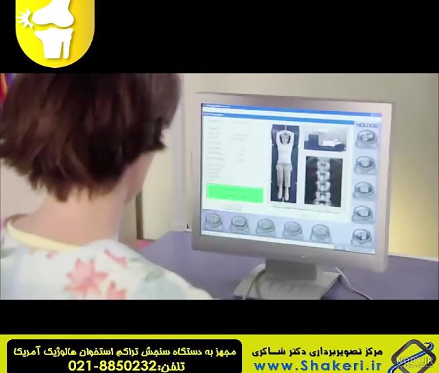 عکس جنین پسر در هفته 17 بارداری